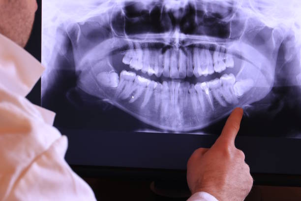 Best Emergency Treatment for Toothache in Fishersville, VA
