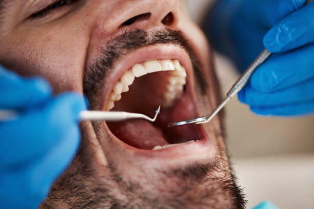 Best Same-Day Emergency Dentist in Fishersville, VA
